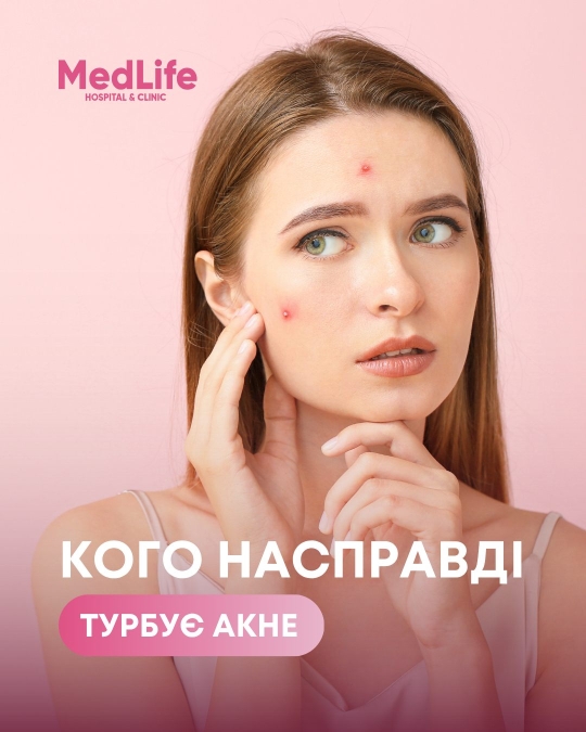 Кого насправді турбує акне